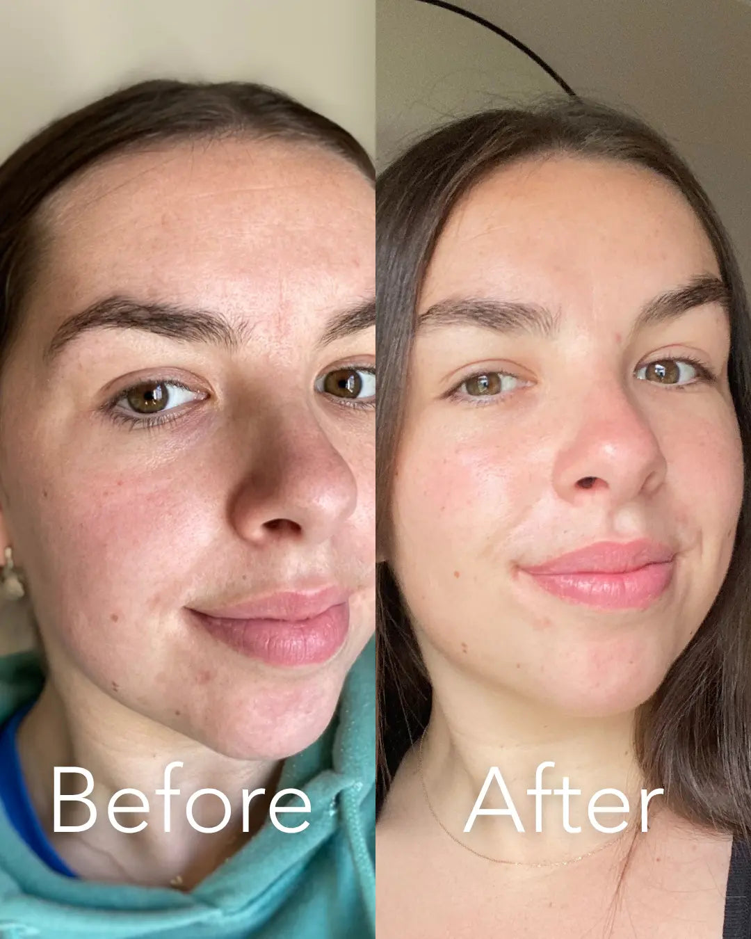 The Essentials Bundle