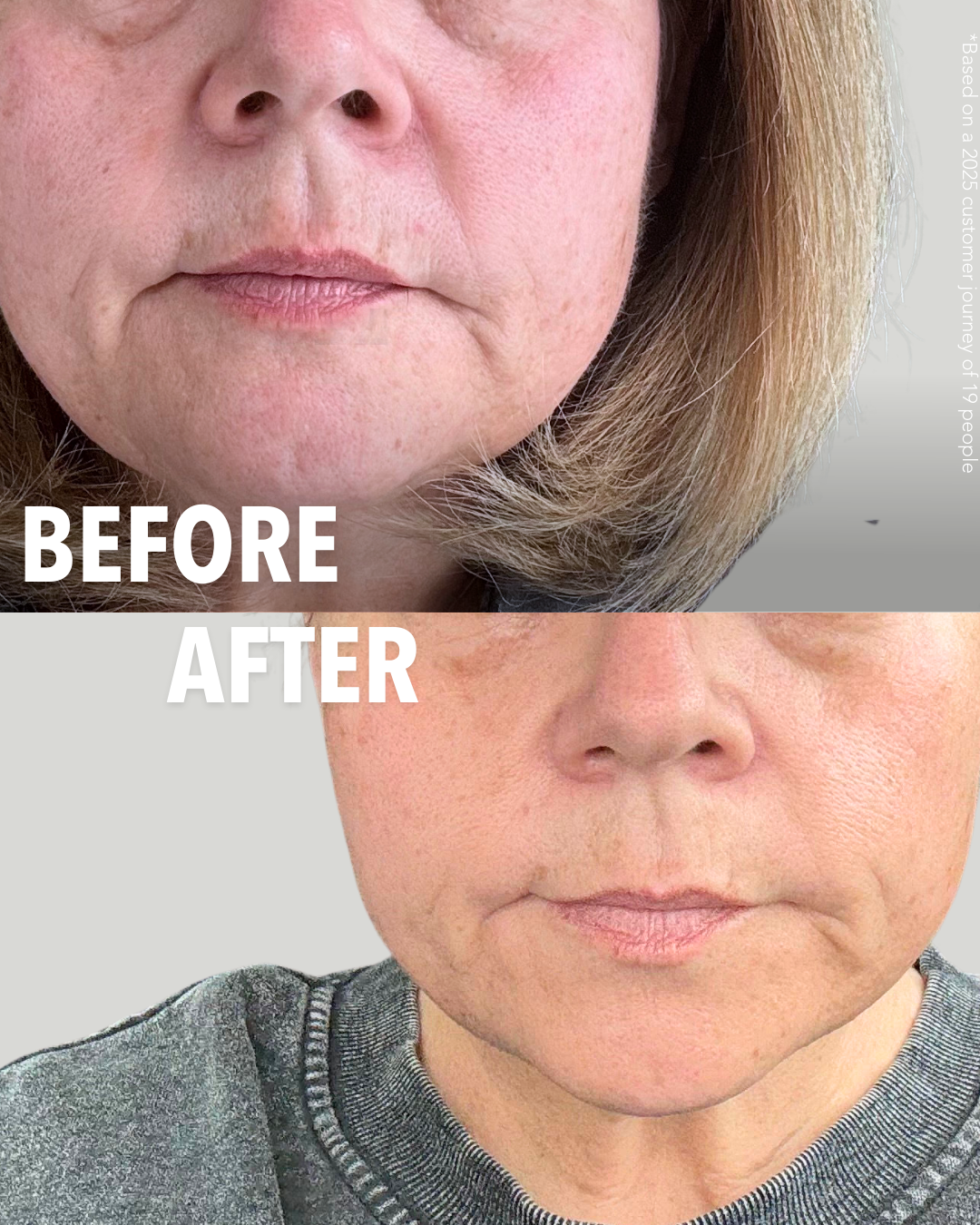 Pro-Aging Bundle