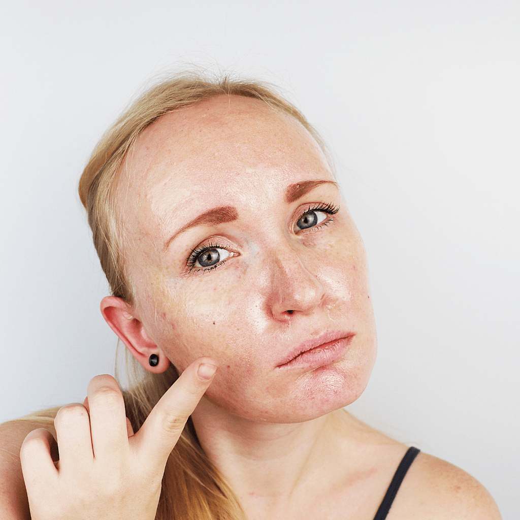 How To Help Manage Very Oily Skin