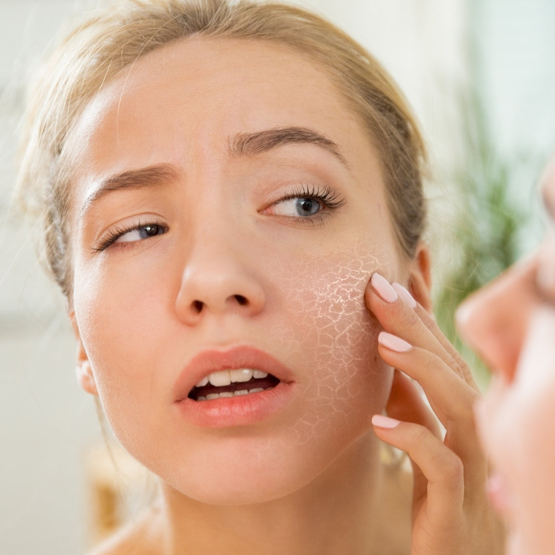 Normal to Dry Skin