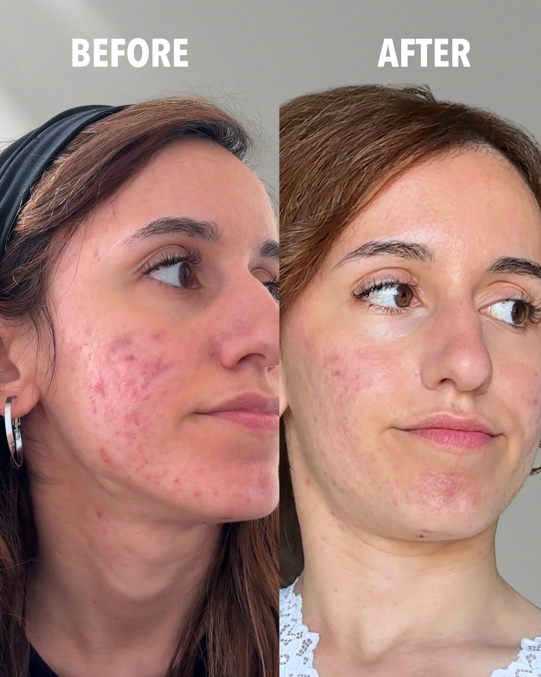 Combination Skin Bundle